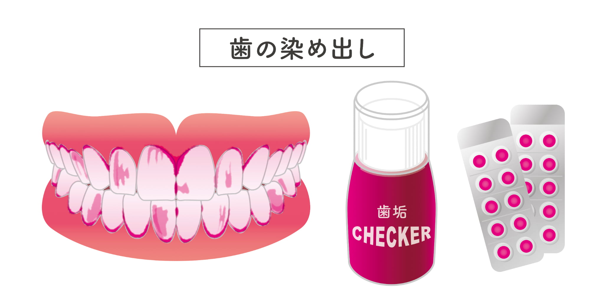 歯の染め出しのイメージ図